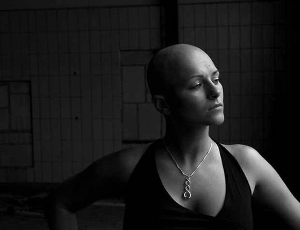 mulher_careca-620x475